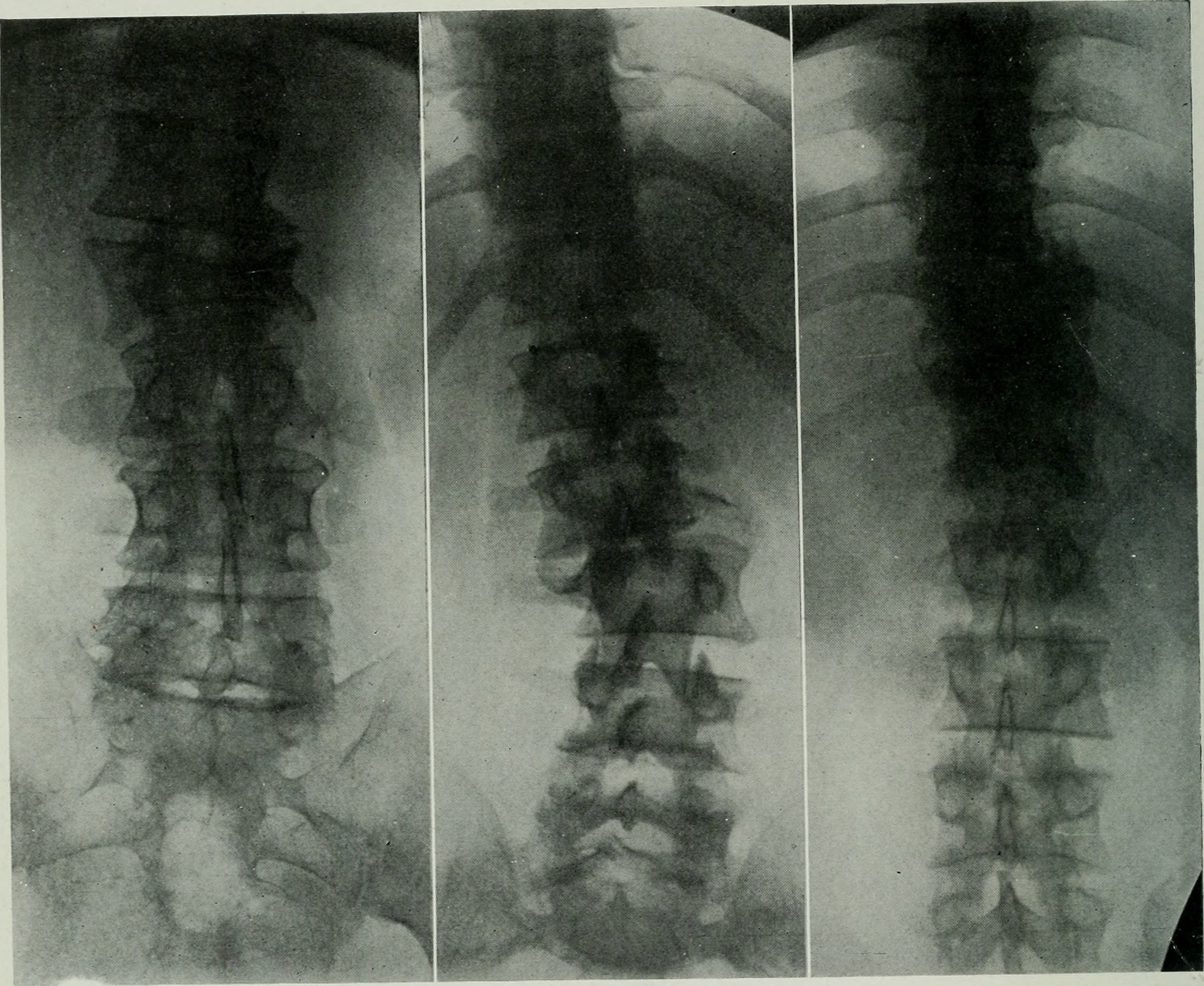 diagnostic-radiology-spine.jpg
