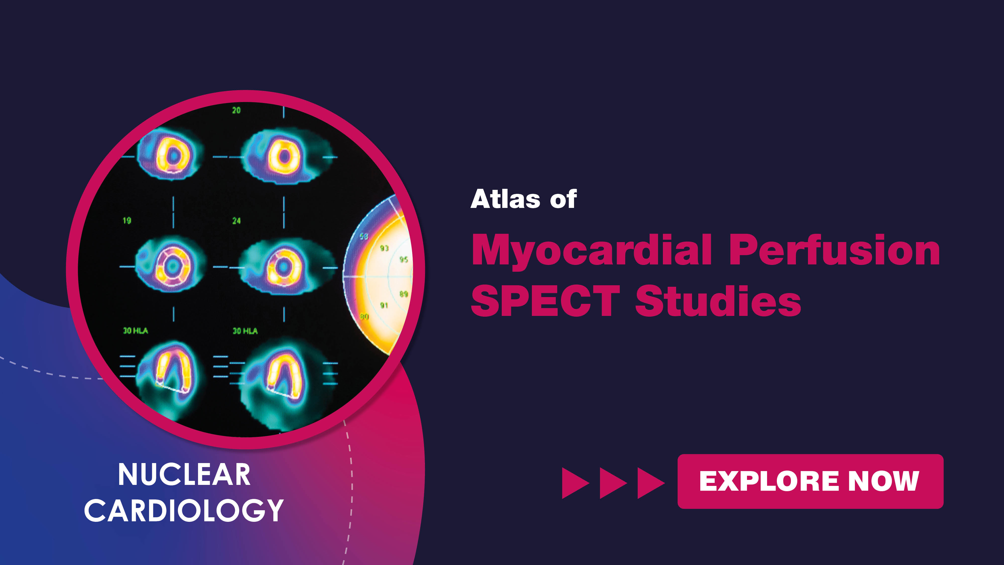 atlasofmyocardialperfusionspectstudies.jpg