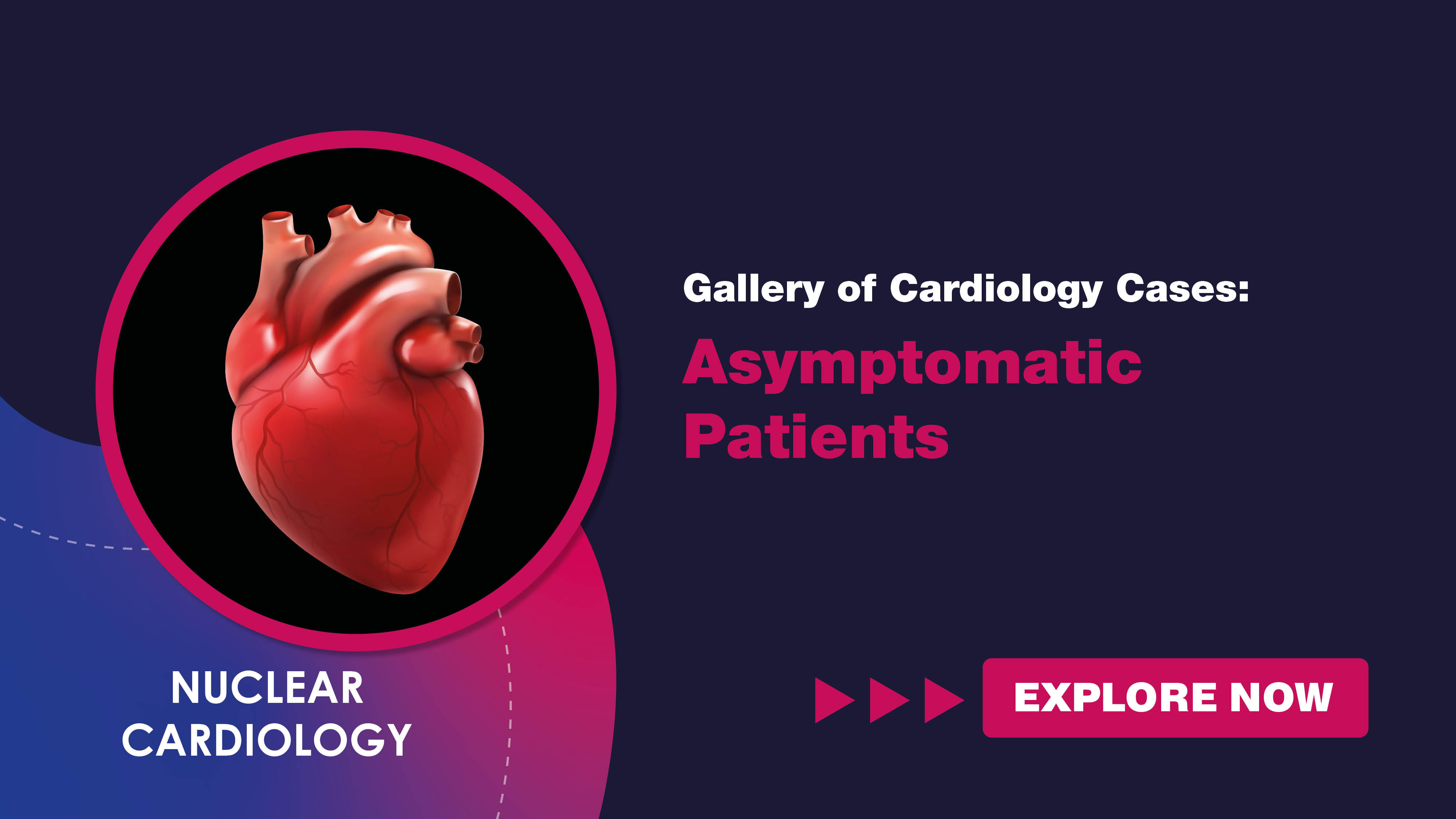 galleryofcardiologycasesasymptomaticpatients.jpg