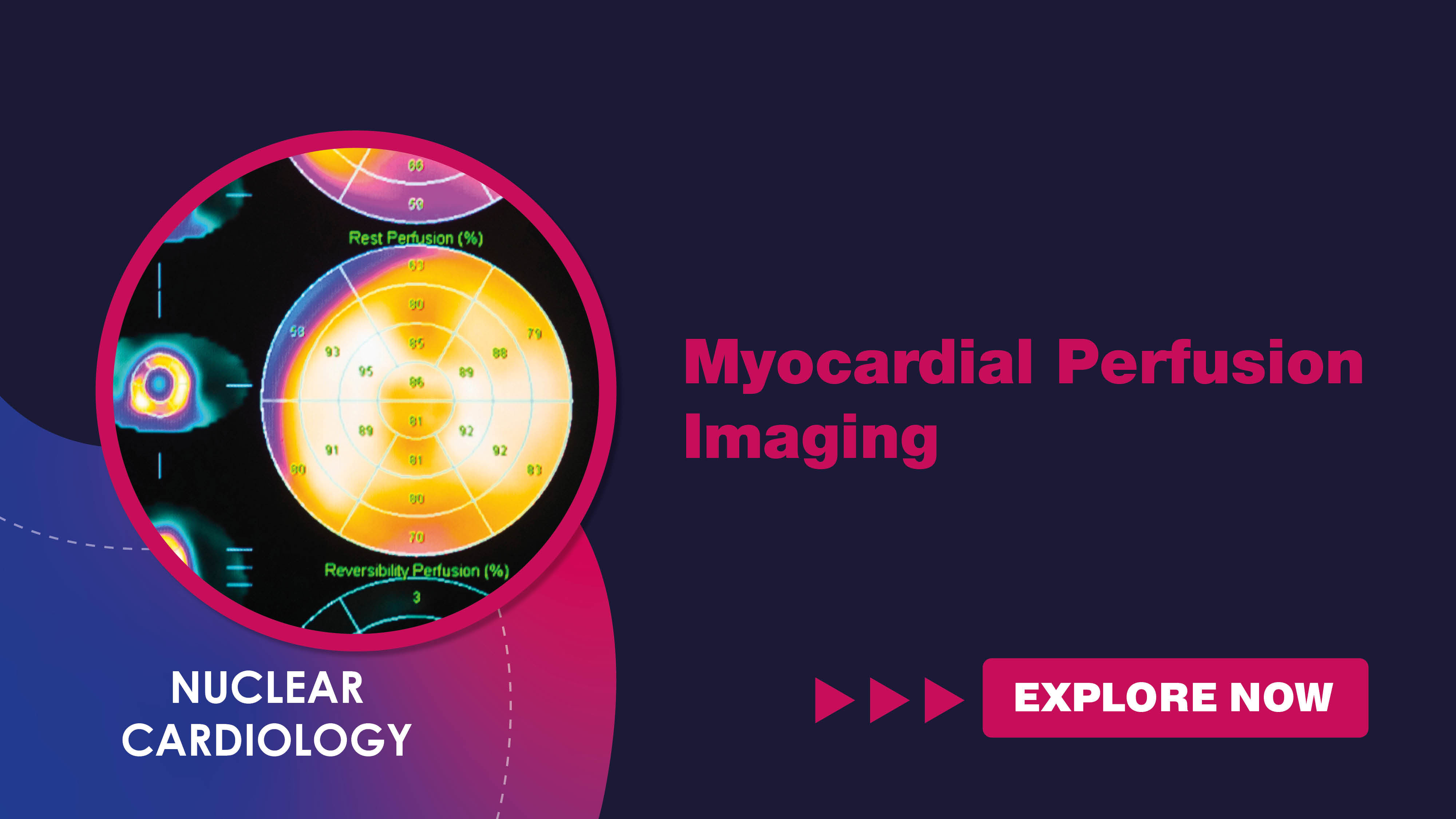 myocardialperfusionimaging.jpg