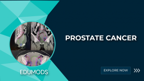 Anatomic Considerations in the Management of Clinically Localized Prostate Cancer: Organs at Risk