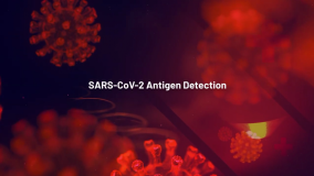 Antigen detection (French)