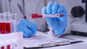 Serology - quality control (Russian)