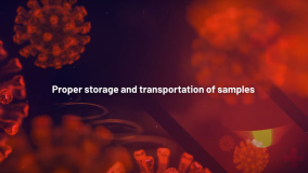 Proper sample storage and transportation (Russian)