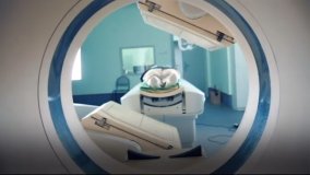 Partenariat BID-AIEA pour la lutte contre les cancers féminins (en anglais)