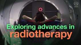 Exploring Advances in Radiotherapy