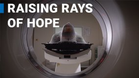 Raising Rays of Hope for Cancer Care for All