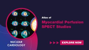 Atlas of Myocardial Perfusion SPECT Studies