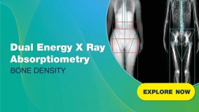 Dual Energy X Ray Absorptiometry - DXA