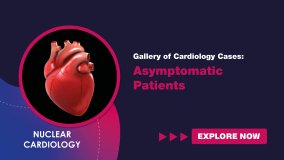 Gallery of Cardiology Cases: Asymptomatic Patients