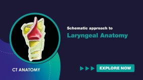 Schematic Approach to Laryngeal Anatomy
