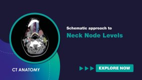 Schematic Approach to Neck Node Levels (English)