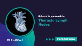 Schematic Approach to Thoracic Lymph Nodes (English)