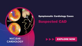Symptomatic Cardiology Cases - Suspected CAD