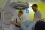 Before the radiotherapy procedure, the radiation therapist leaves the room to perform the treatment. The patient is always monitored by the radiation therapists who can see and hear the patient and can speak to the patient using an intercom system.