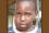 This little boy is suffering from an endemic form of Burkitt's Lymphoma, a cancer which often attacks the jaw or facial bones in children. 