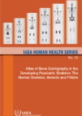 Atlas of Bone Scintigraphy in the Developing Paediatric Skeleton: The Normal Skeleton Variants and Pitfalls