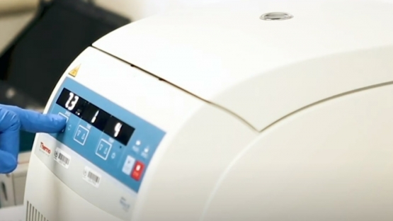 RT-PCR