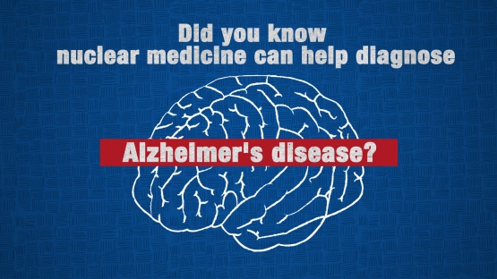 Alzheimer's Disease